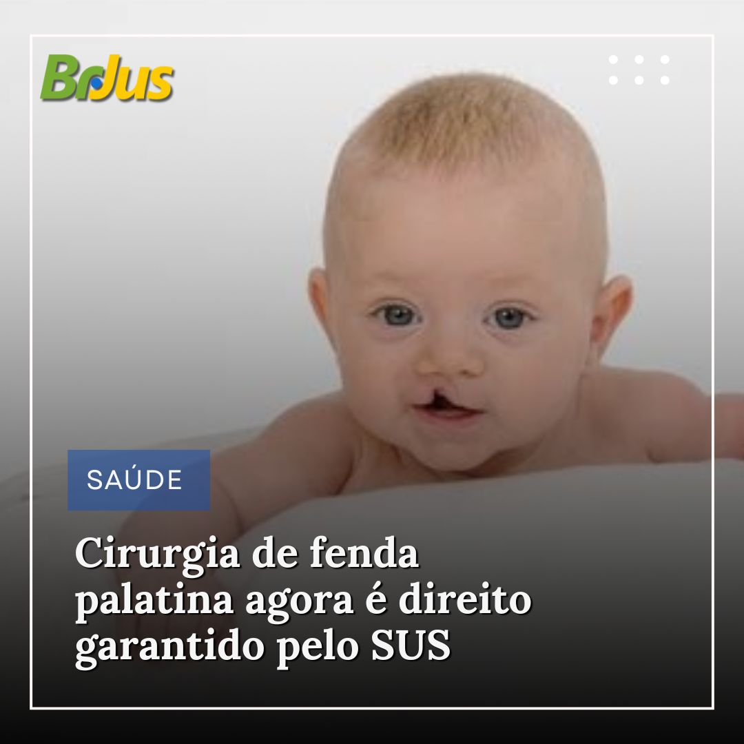 Cirurgia de fenda palatina agora é direito garantido pelo SUS